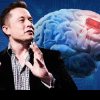 Primul pacient cipat de Elon Musk sfidează legile naturale: Poate controla mouse-ul unui calculator prin gândire!