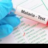 Rafila: În fiecare an se întâmplă să moară români de malarie. Nu trebuie să cădem într-o extremă, să nu mai mergem în vacanţe
