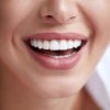 De ce unii oameni au mai mulți dinți decât alții? Explicația medicul stomatolog!