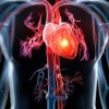 Medic: Hipertensiunea arterială este una dintre cele mai neglijate boli / Apare pe măsură ce avansăm în vârstă