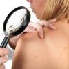 Tehnologie pentru depistarea cancerului de piele prin metode non-invazive, la Spitalul de Boli Infecţioase Galaţi