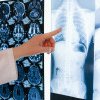 Oscilometria de impuls: metoda rapidă să afli că plămânii tăi sunt sănătoși