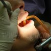 Hunedorenii asigurați și neasigurați pot beneficia de servicii stomatologice gratuite