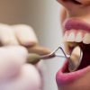 18% dintre români nu au fost la stomatolog în ultimii cinci ani. România, ultimul loc în UE la sănătate orală