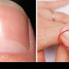 Ce semnifică semiluna albă de pe unghiile tale. Atenție: marimea sa poate semnala boli de inimă