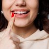 3 tipuri de fațete dentare și când sunt recomandate
