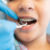 Abordări inovatoare în pedodonție: utilizarea aparatului dentar