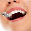 Cum îți poți menține dinții sănătoși pe termen lung. Sfaturi de la specialiști