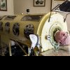 „Polio Paul” a murit. Povestea bărbatului paralizat de la gât în jos care a trăit 70 de ani într-un „plămân de fier”