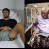 Survivor All Stars, 26 martie. Alex Delea, declarații de pe patul de spital: „Nu mă gândeam să fie scenariul atât de rău”