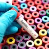 Blenoragia, sifilisul, chlamydia…, în continuă creștere, în Europa