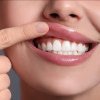 Ce este zâmbetul gingival și cum se poate trata la stomatolog