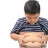 Studiu: Obezitatea infantilă crește riscul de probleme musculo-scheletice