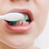 Parodontoza, boala care poate cauza pierderea dinților
