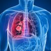 Un medicament-speranță pentru pacienții diagnosticați cu o formă de cancer pulmonar agresiv