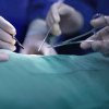 O tumoră de 45 de kilograme a fost scoasă din abdomenul unei femei din Botoșani, care a mers la medic când a văzut că se îngrașă brusc