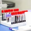 Vrancea: Restricţii la donarea de sânge după ce Centrul de Transfuzie Sanguină a anunţat că are stoc excedentar