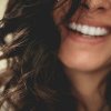Estetica dentară și rolul implanturilor: cum să obții o dantură perfectă