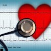 Cardiovascular diseases, main cause of death in Romania, every 30 minutes one Romanian dies of heart attack