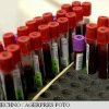 Descoperire revoluționară făcută de cercetători: O singură doză dintr-o nouă clasă de antibiotice a tratat infecțiile din sânge în doar 4 ore