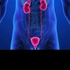 Explicația oamenilor de știință pentru creșterea puternică a numărului cancerelor de prostată la nivel mondial