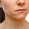 Un medic dermatolog sparge barierele: Afectiunile pielii sunt expresii cutanate ale unor boli psihice
