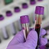 Medic timișorean: „Peste 50% dintre rezultatele investigațiilor de laborator sunt eronate din cauza conduitei pacientului”