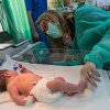 Apel: Trebuie dotate urgent maternitățile și secțiile de terapie intensivă neonatală, pentru a combate mortalitatea infantilă