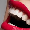 Remediu natural pentru albirea dinților. Internetul a luat foc după ce o internaută a împărtășit rețeta: japonezii o folosesc cu succes de sute de de ani