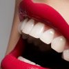 Remediu natural pentru albirea dinților. Internetul a luat foc după ce o internaută a împărtășit rețeta: japonezii o folosesc cu succes de sute de de ani