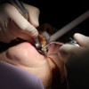 Mii de sălăjeni se confruntă cu probleme dentare grave