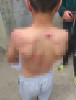 FOTO Un copil de 10 ani din Galați, bătut crunt cu biciul, după ce ar fi speriat calul unor rude