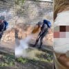 (video) Caz îngrozitor în Rusia: Un copil s-a ales cu traumatisme, după ce un cheg de la bere cu care se juca i-a explodat în față