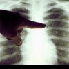 Spirometrii gratuite în țară, în acest weekend. Luptă împotriva astmului
