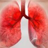 Cum poate fi gestionat astmul bronșic în viața de zi cu zi