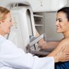 SĂNĂTATEA FEMEILOR Care este vârsta ideală la care ar trebui făcută prima mamografie?