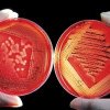 Medicii timișoreni atrag atenția asupra pericolului reprezentat de bacteria care hrănește cu carne